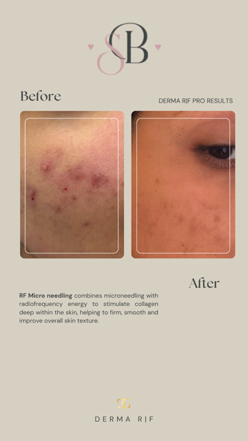 Before-After-7