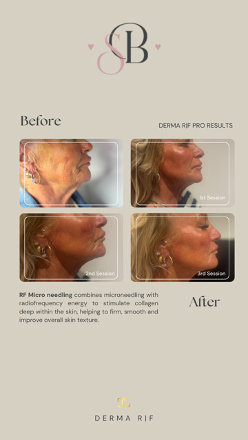 Before-After-8