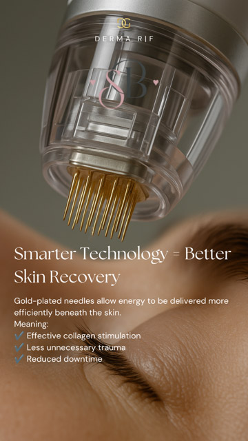 RF-Microneedling
